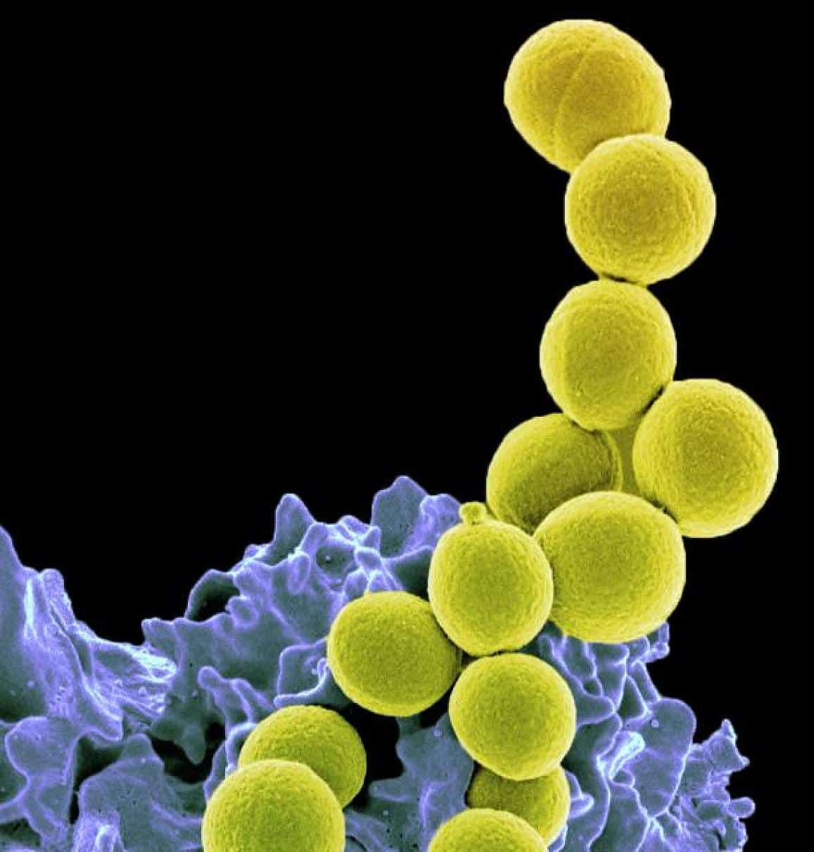 A Probiotic May Control Serious Antibiotic-Resistant Staph Infection