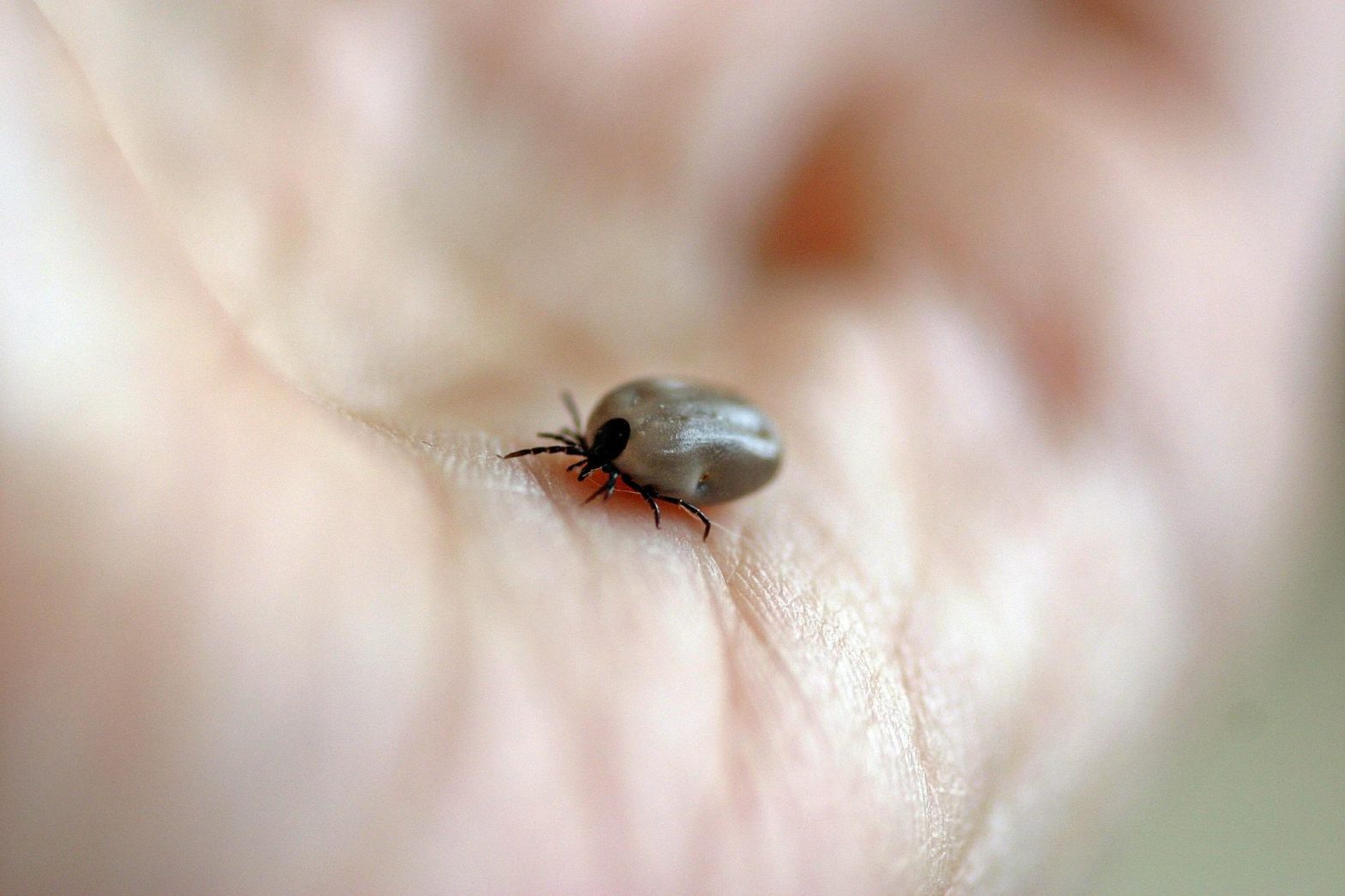 Toddler Develops Long-Term Illness Due to Rare Virus From Tick Bite