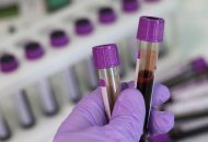 FDA Approves a CRISPR-Based Medicine to Treat Sickle Cell Disease