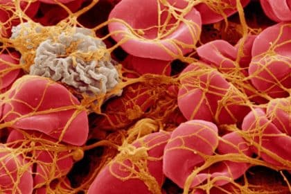Johns Hopkins Study Highlights Patient Role in Successful Use of Clot-Busting Drugs