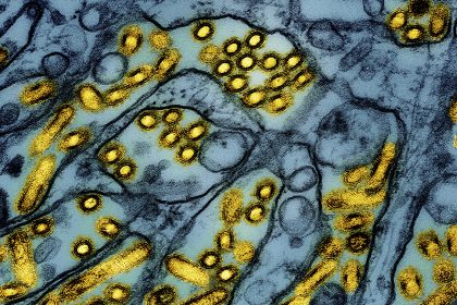 First US Bird Flu Death Is Announced in Louisiana