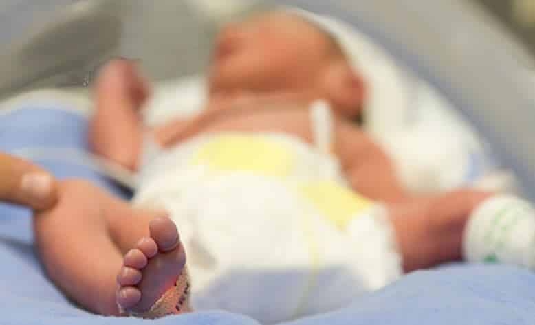 Prenatal Steroid Treatment May Improve Survival for Extremely Preterm Infants