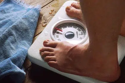 Pandemic Meets Epidemic: Obesity and COVID-19