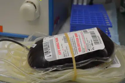 Blood Donations Safe Under Current COVID-19 Screening Guidelines