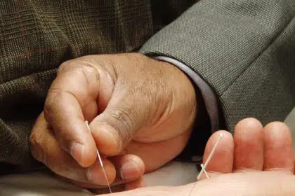 How Acupuncture May Help Treat COVID-19