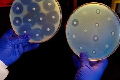 Federal Efforts Aim to Combat ‘Silent Pandemic’ of Antimicrobial Resistance  