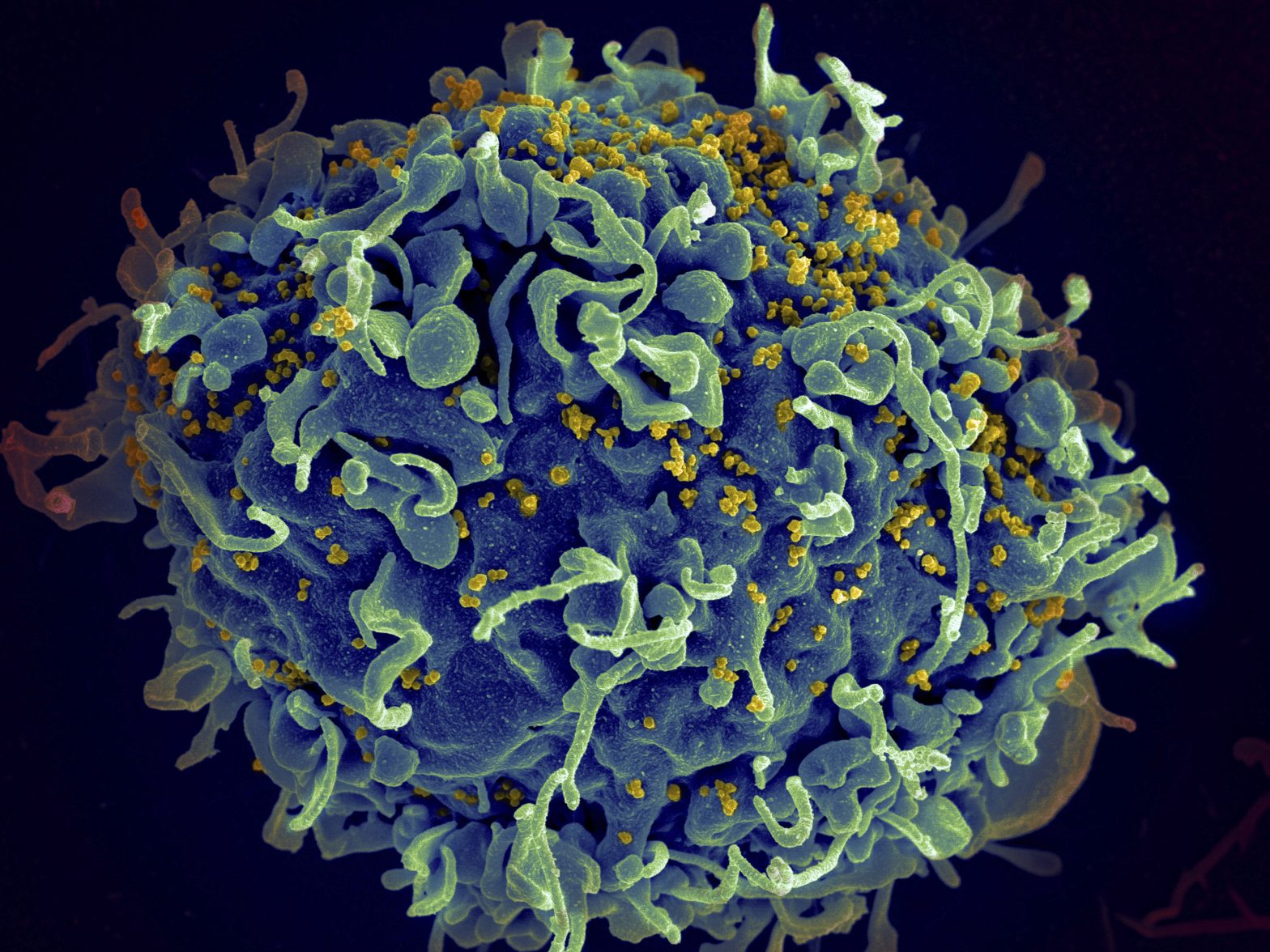 Climate Change May Increase Risk of New Infectious Diseases