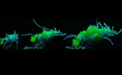 Study Identifies ‘Creature’ That Promotes Tooth Decay