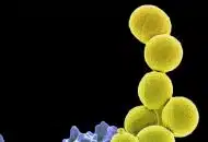 A Probiotic May Control Serious Antibiotic-Resistant Staph Infection