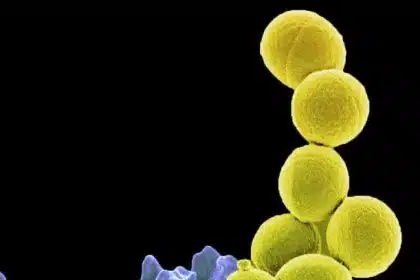 A Probiotic May Control Serious Antibiotic-Resistant Staph Infection